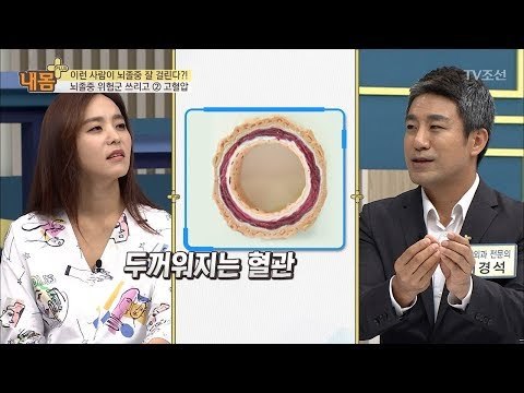 고혈압-고지혈증, 뇌졸중 걸리기 쉽다?! [내 몸 플러스] 77회 20171022