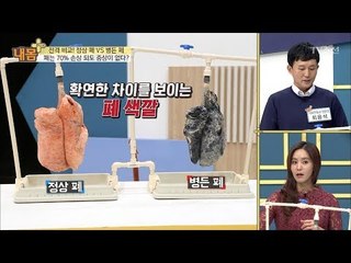 정상 폐 vs 병든 폐, 전격 비교! [내 몸 플러스] 80회 20171119