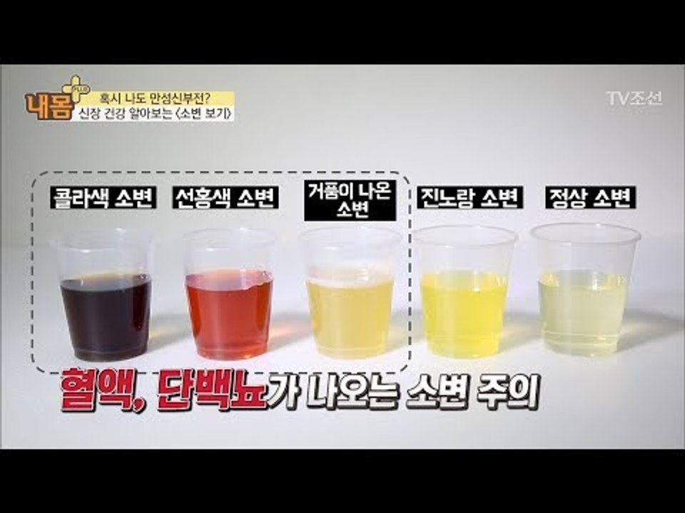 ‘소변의 색’으로 신장 건강을 알아보자 [내 몸 플러스] 82회 20171203