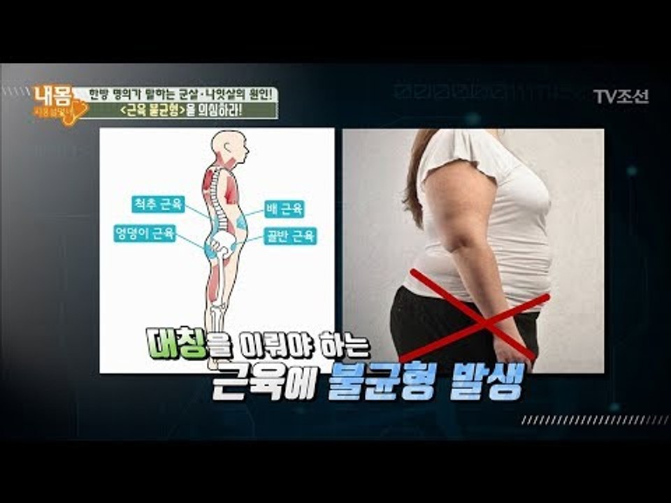 한방 명의가 말하는 비만의 원인 ‘근육 불균형’ [내 몸 사용설명서] 181회 201...