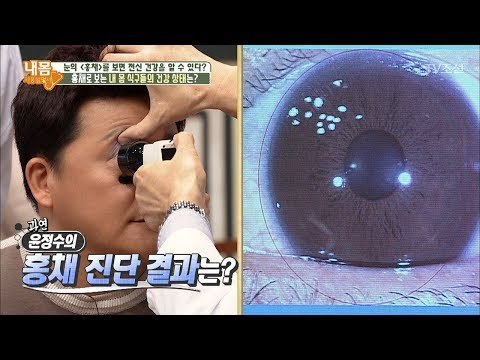 홍채로 본 윤정수의 건강 상태! 역류성 식도염이? [내 몸 사용설명서] 182회 20171208