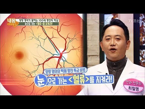 100세 명안의 핵심! 눈으로 가는 ‘혈류’를 지켜라! [내 몸 사용설명서] 182회 20171208