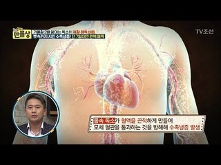 몸속 독소가 ‘수족냉증’을 발생시킨다! [만물상 223회] 20171214