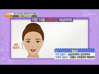 부정교합 진단법! ‘얼굴키’를 확인하라! [내 몸 사용설명서] 187회 20180112