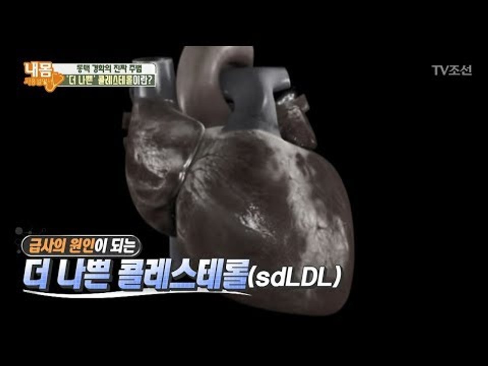 나쁜 콜레스테롤보다 ‘더 나쁜’ 콜레스테롤이란? [내 몸 사용설명서] 183회 201...