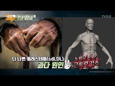중년 ‘여성’에게 더 치명적인 ‘더 나쁜’ 콜레스테롤, 그 이유는? [내 몸 사용설명서] 183회 20171215