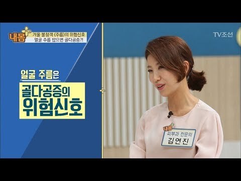 얼굴 주름 많으면 골다공증의 위험 신호?! [내 몸 플러스] 84회 20171217