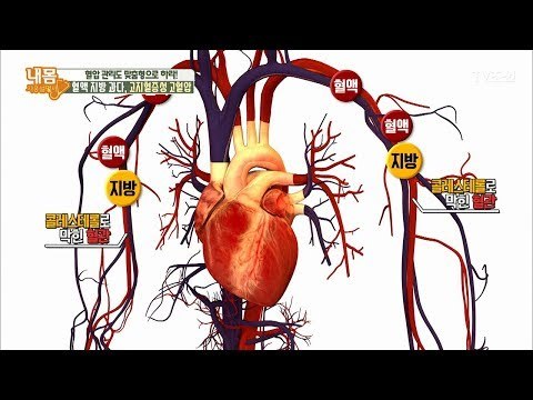 중성지방이 있으면 왜 혈압이 높아지는가! [내 몸 사용설명서] 189회 20180126