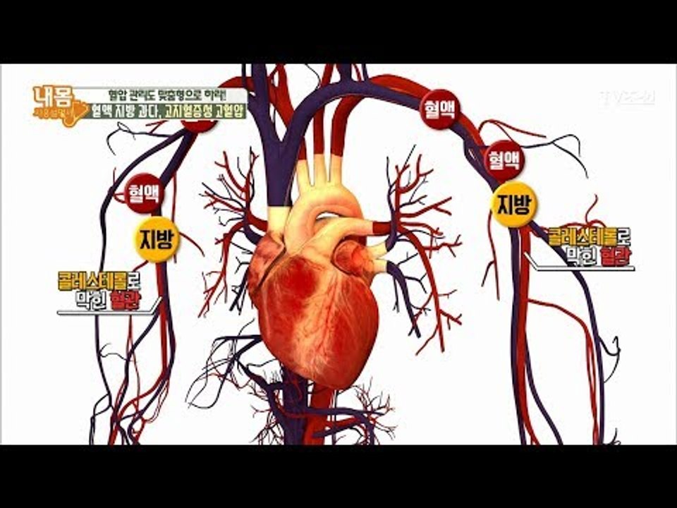 중성지방이 있으면 왜 혈압이 높아지는가! [내 몸 사용설명서] 189회 20180126