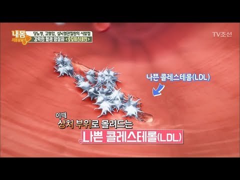 강력한 혈관 암살자 ‘호모시스테인’ [내 몸 사용설명서] 185회 20171229
