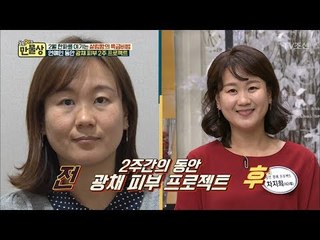 연예인들의 광채 피부 따라잡기 2주 프로젝트! 그 결과는?! [만물상 230회] 20180201