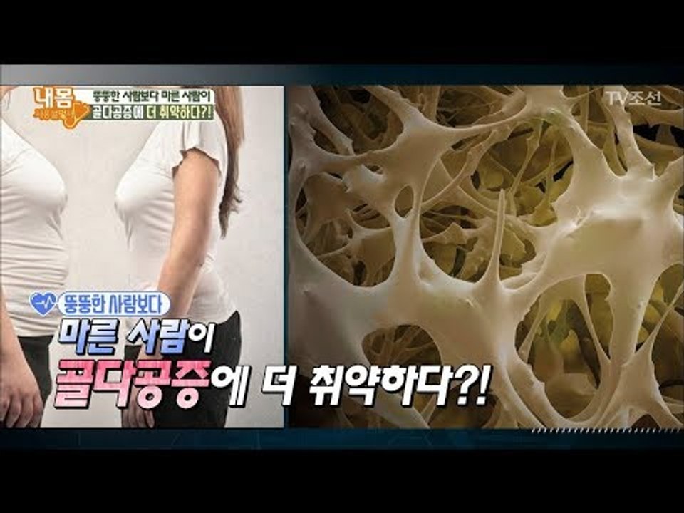 마른 사람이 ‘골다공증’에 더 취약하다?! [내 몸 사용설명서] 191회 20180209