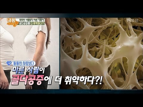 마른 사람이 ‘골다공증’에 더 취약하다?! [내 몸 사용설명서] 191회 20180209