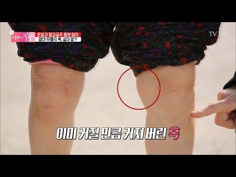 엄마의 다리에 이미 커져버린 혹! 설마 암?! [엄마의 봄날] 129회 20180225