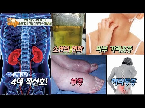 콩팥 건강 ‘4대 적신호’의 마지막 신호, 부종! [내 몸 사용설명서] 201회 20180420