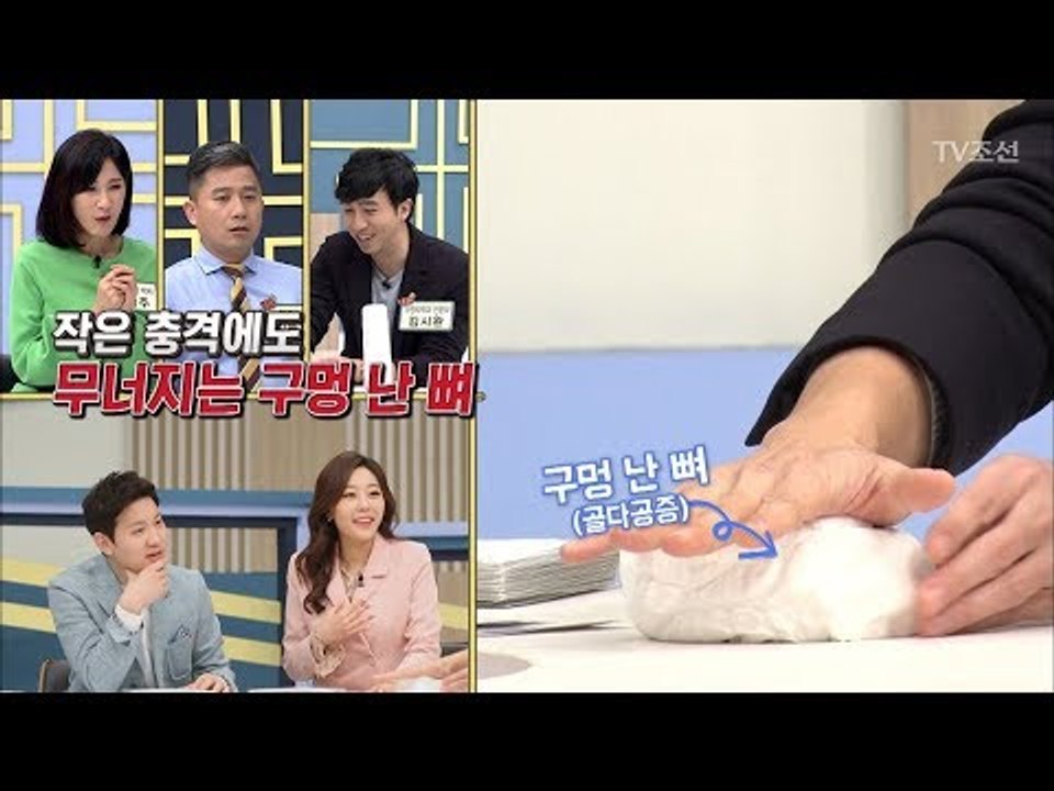 모두를 놀라게 만든 구멍 난 뼈의 부실함! [내 몸 플러스] 98회 20180422