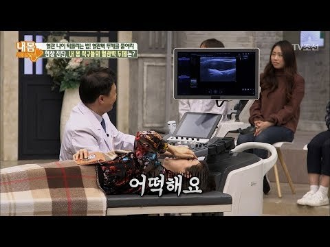 현장진단! 출연진의 혈관벽 두께는? 경악스러운 결과! [내 몸 사용설명서] 197회 20180323