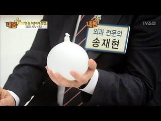 얕잡아 봐서는 안 될 몸속 위험한 혹의 정체는? [내 몸 플러스] 99회 20180429