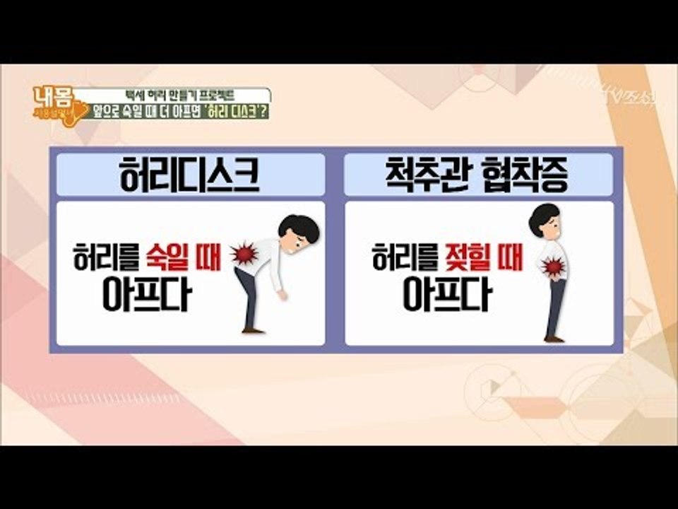 '허리 디스크'와 '척추관 협착증' 구별 방법! [내 몸 사용설명서] 203회 201...
