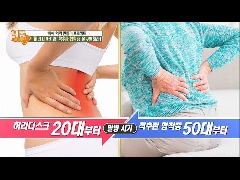중장년층의 고질병! 허리 통증의 원인은? [내 몸 사용설명서] 203회 20180505