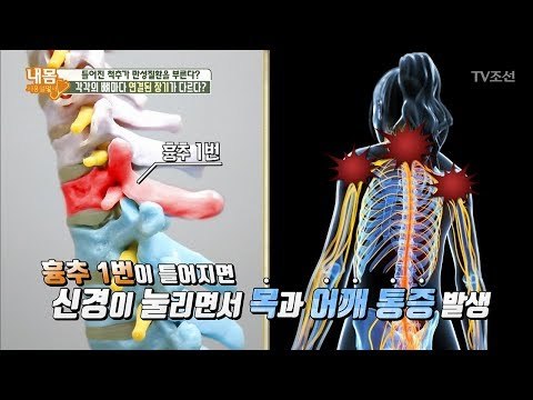 ‘이곳’ 눌러 아프다면?! 어깨, 목에 문제가?! [내 몸 사용설명서] 207회 20180602