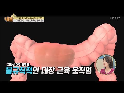 [예민 보스] 내시경으로도 알 수 없는 증후군?! [내 몸 플러스] 104회 20180603