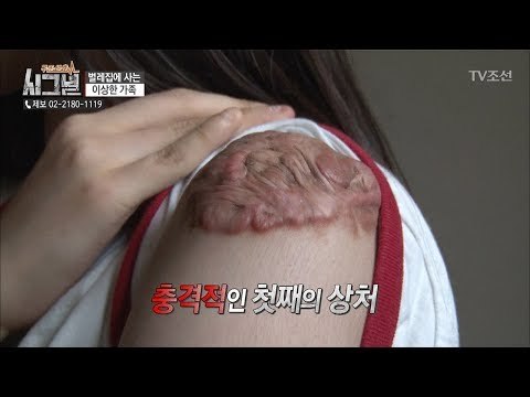 아이의 종양화된 충격적인 상처...치료가 시급하다 [시그널] 29회 20180615
