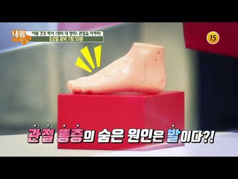 여름 건강 백서 '명의 대 명의' 관절을 지켜라!_내 몸 사용설명서 211회 예고