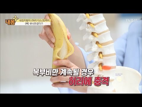 ‘이것’ 때문에 뼈까지 무너져 내린다! 그 정체는? [내 몸 플러스] 107회 20180701