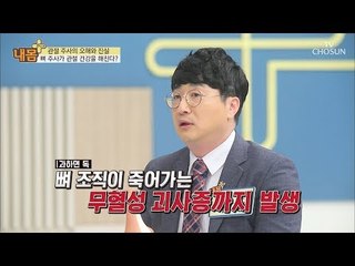 뼈에 주사를?! 관절 주사의 오해와 진실! [내 몸 플러스] 110회 20180819