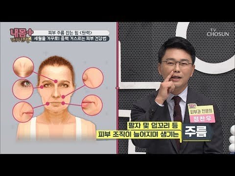 여성의 피부 고민이자 노화의 대표주자 주름! 주름의 원인 파헤치기~ [내 몸 플러스] 115회 20181007
