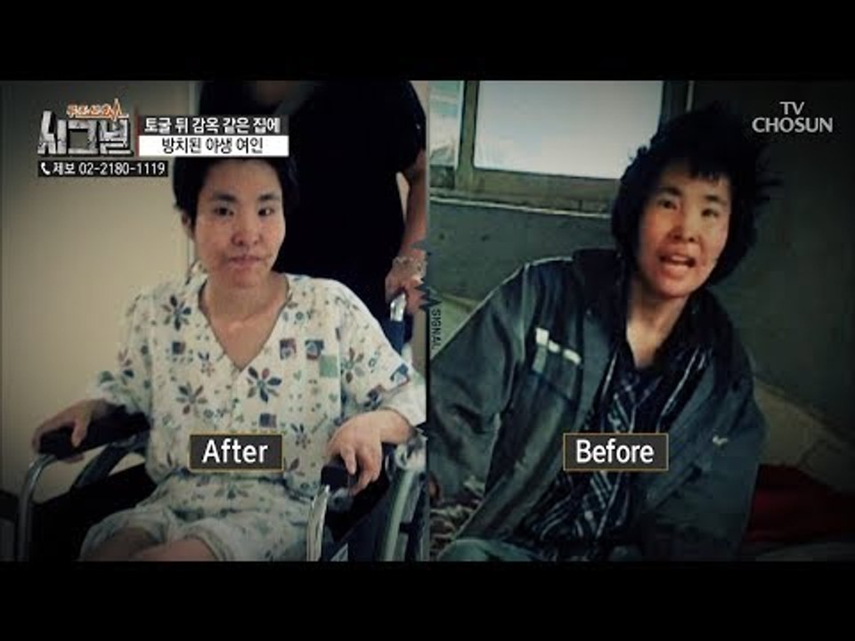 치료를 받기로 결심한 성화 씨! 목욕 후 너무나 달라진 모습 [시그널] 39회 201...