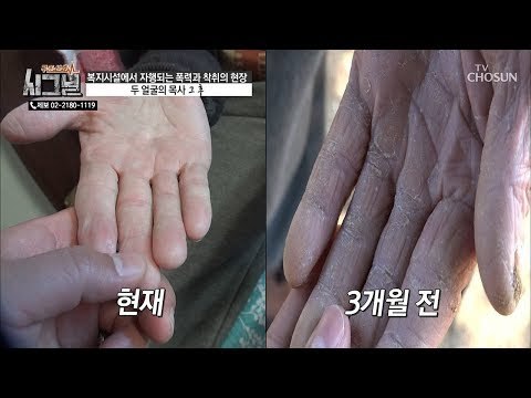 고된 노동의 흔적이 싸~악 사라진 할아버지의 손! [시그널] 56회 20190102