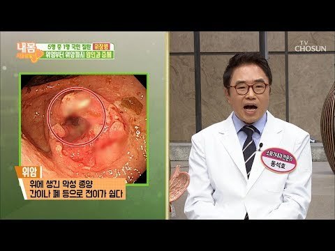 국민 질환 위장병! 40대 이상이면 위암 검사 필수! [내 몸 사용설명서] 238회 20190208