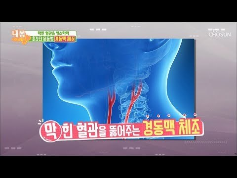뇌혈관 질환 예방 하려면? 경동맥 체조! [내 몸 사용설명서] 236회 20190118