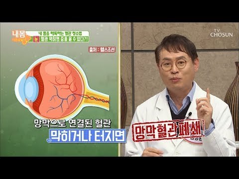 눈이 충혈되면 중풍 올 수 있다?! [내 몸 사용설명서] 236회 20190118