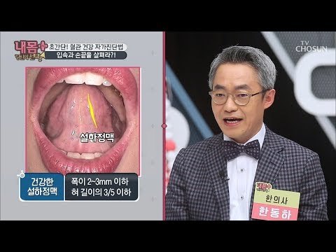 초간단 혈액 상태 확인! 입속과 손끝을 살펴라! [내 몸 플러스] 126회 20181230