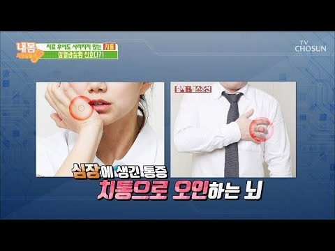 심장에 생긴 통증! 치통으로 오인하는 뇌? [내 몸 사용설명서] 240회 20190222