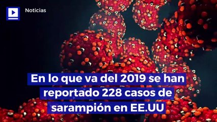 En lo que va del 2019 se han reportado 228 casos de sarampión en EE.UU
