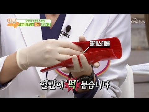 당신의 심장을 노린다! 돌연사를 부르는 ‘혈전’의 정체는? [내 몸 사용설명서] 240회 20190222