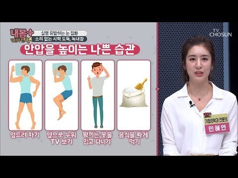 소리 없는 시력 도둑? 공통 원인 파악하기! [내 몸 플러스] 134회 20190303
