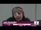 Mujer sobreviviente a un ataque con ácido ¡llama a las víctimas a denunciar! | Yuriria Sierra