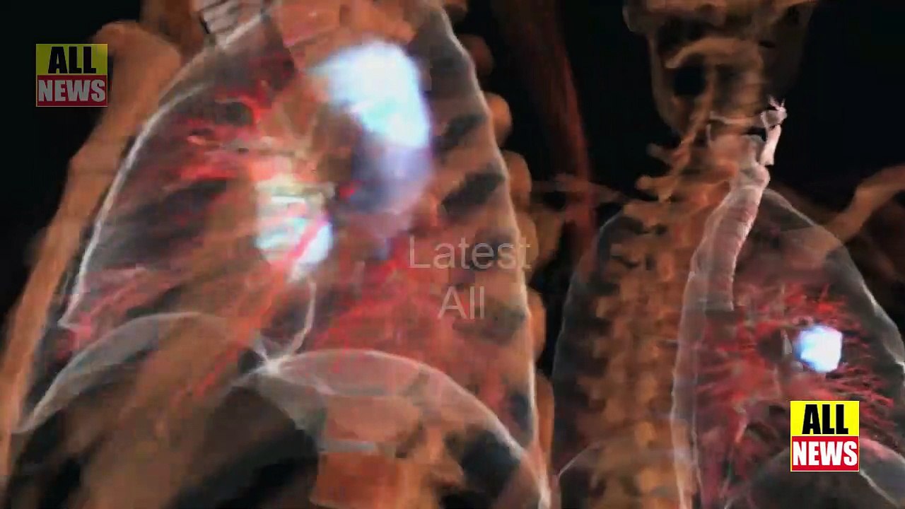 انسانی طرز زندگی میں تبدیلی کینسر کی بڑی وجہ ہے |Stop Cancer | Ary News Headlines