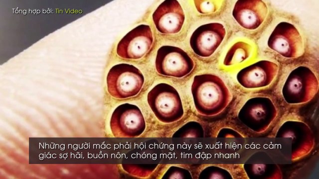 MS GIẢI MÃ BÍ ẨN NHỮNG NỖI SỢ HÃI PHỔ BIẾN TRÊN THẾ GIỚI, SỐ 9 CÓ NHIỀU NGƯỜI SỢ NHẤT