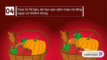 BS Tuyền chia sẽ 10 điều bạn cần biết trước khi Phẫu Thuật Thẩm Mỹ