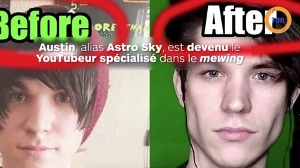La tendance du mewing expliquée