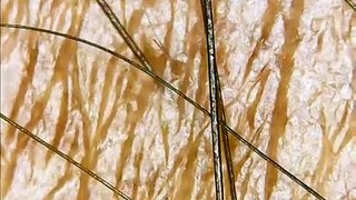 microscopic view of human skin, hair and hair root