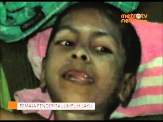 Remaja Ini Butuh Bantuan, Tulangnya Mengecil dan Lumpuh