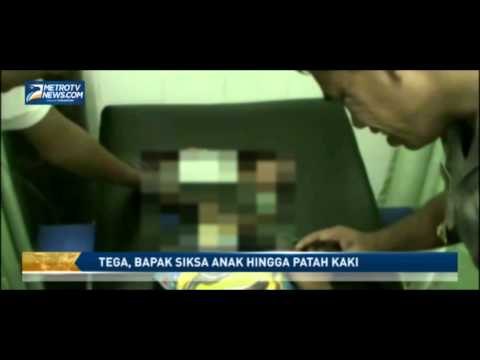 Tega, Bapak Siksa Anak Hingga Patah Kaki
