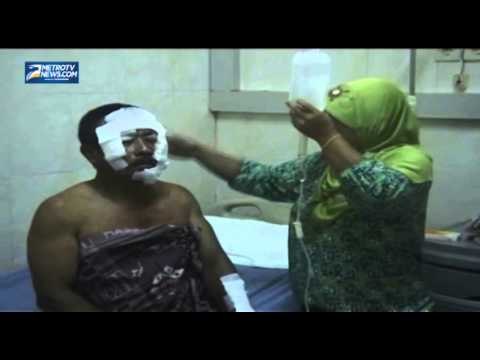 Mesin Oven Pabrik Kerupuk Meledak, Tujuh Pekerja Luka luka